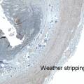 wheater-stripping-sauna-boiling-water.jpg