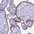 pdl1-placenta.jpg